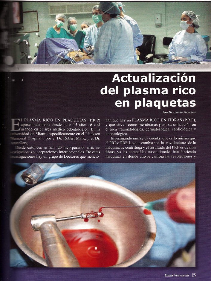 plasma rico en plaquetas prp