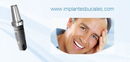 implantes bucales