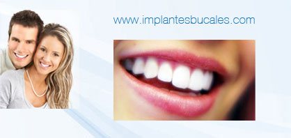 implantes bucales